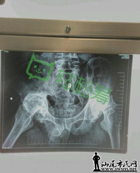 ΢�Ž�ͼ_20160513092228.png