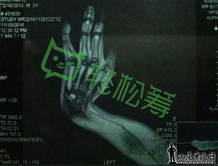΢�Ž�ͼ_20161220090334.png