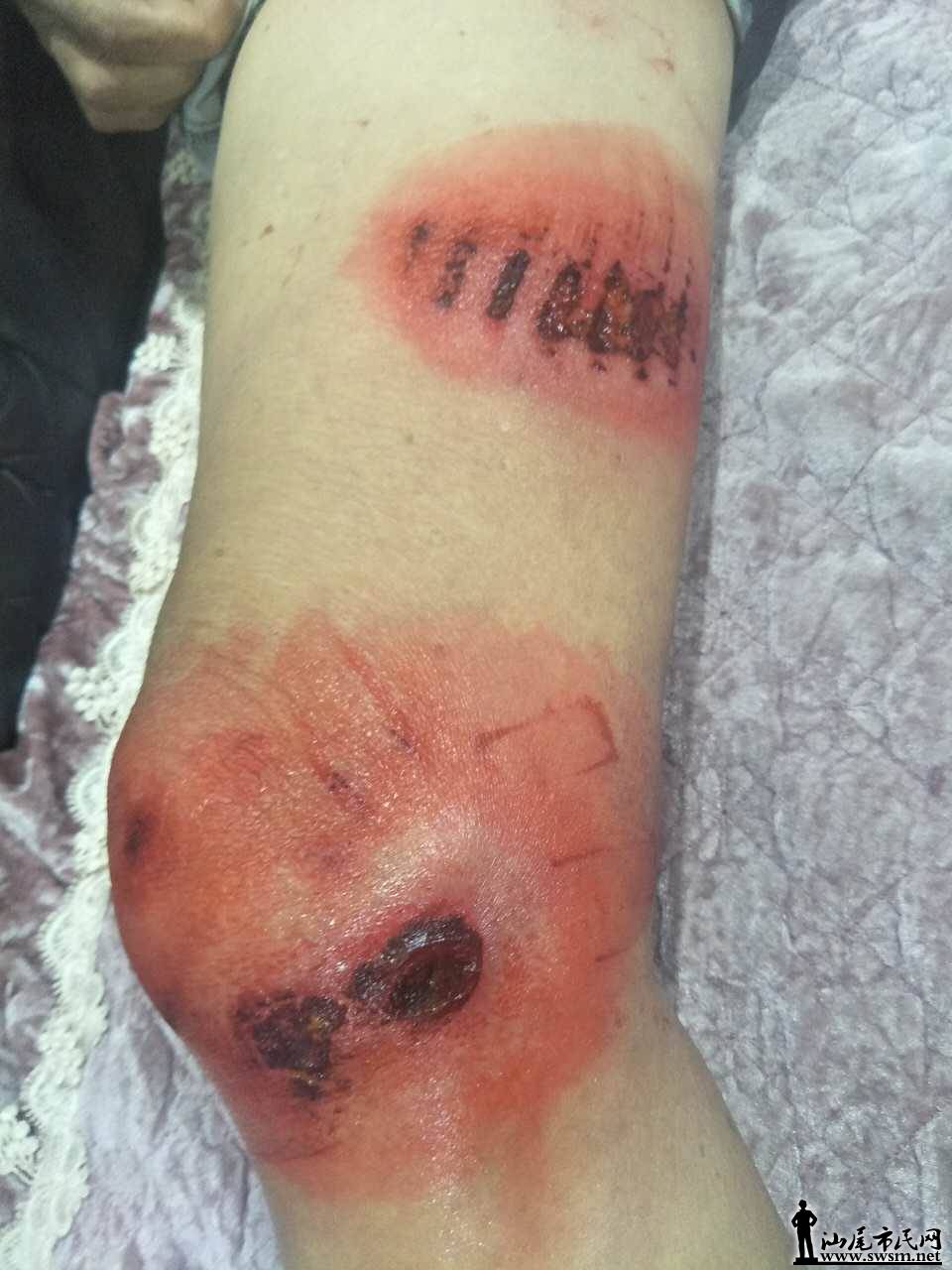 七旬老人被撞入院,寻找肇事者!