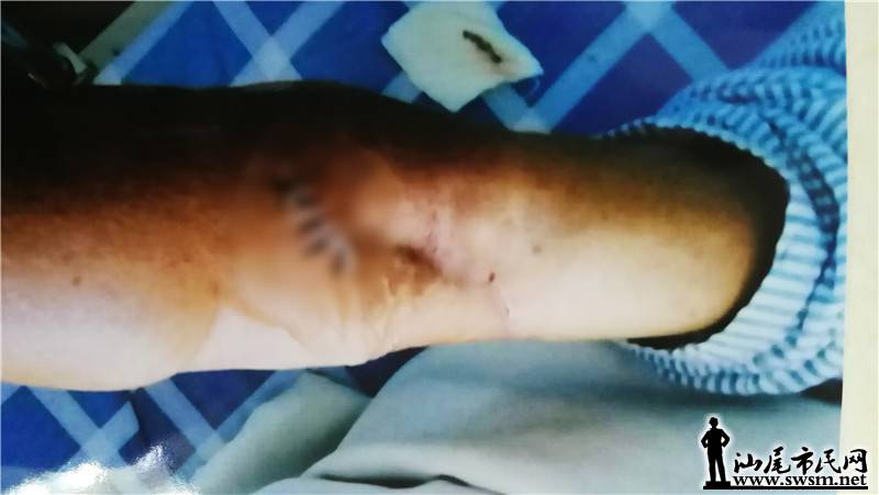 �屣����������Ź�򣬶ദ����