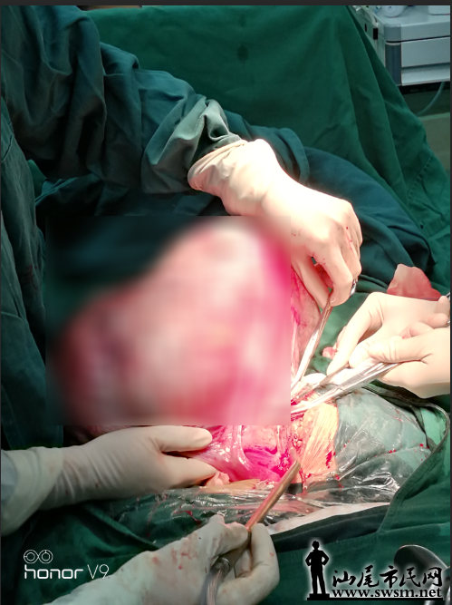 ��β������ҽԺ�ɹ�Ϊ���� ժ��20���ѳ�����