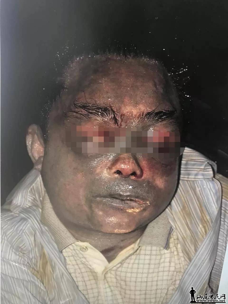 ���㣡½����ʬ���£�������ʶ��