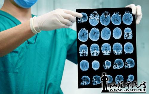 ����X��Ƭ����CT��MRI��飬�ǲ��Ƕ��һ�٣�